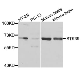 Western Blot - Anti-STK39 Antibody (A7974) - Antibodies.com