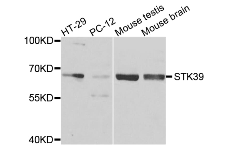 Western Blot - Anti-STK39 Antibody (A7974) - Antibodies.com