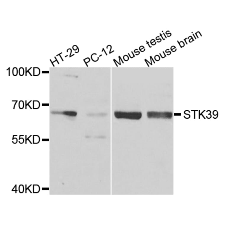 Western Blot - Anti-STK39 Antibody (A7974) - Antibodies.com