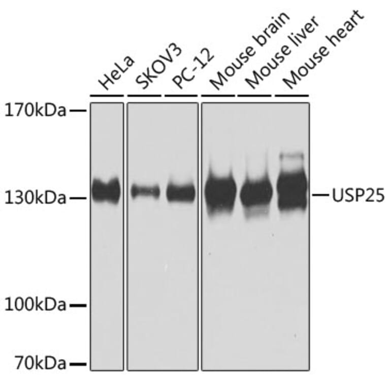 Western Blot - Anti-USP25 Antibody (A7975) - Antibodies.com