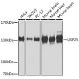Western Blot - Anti-USP25 Antibody (A7975) - Antibodies.com