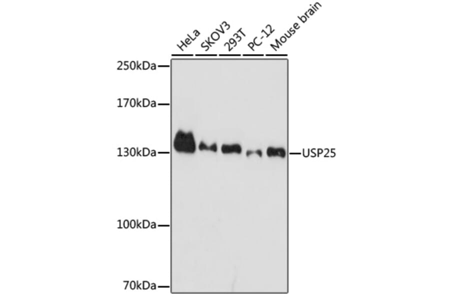 Western Blot - Anti-USP25 Antibody (A7975) - Antibodies.com