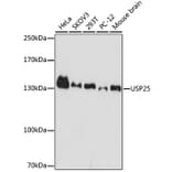 Western Blot - Anti-USP25 Antibody (A7975) - Antibodies.com