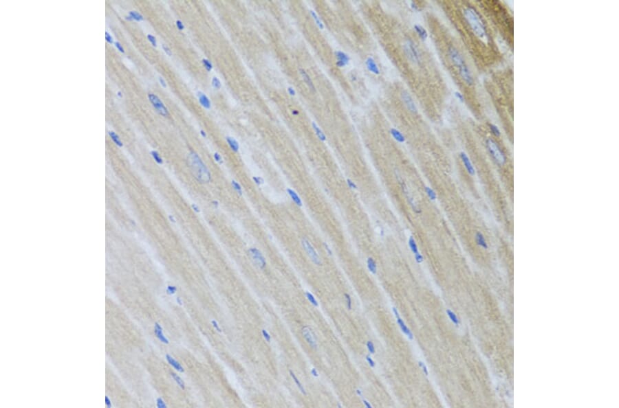 Immunohistochemistry - Anti-USP25 Antibody (A7975) - Antibodies.com