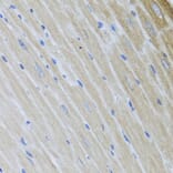 Immunohistochemistry - Anti-USP25 Antibody (A7975) - Antibodies.com
