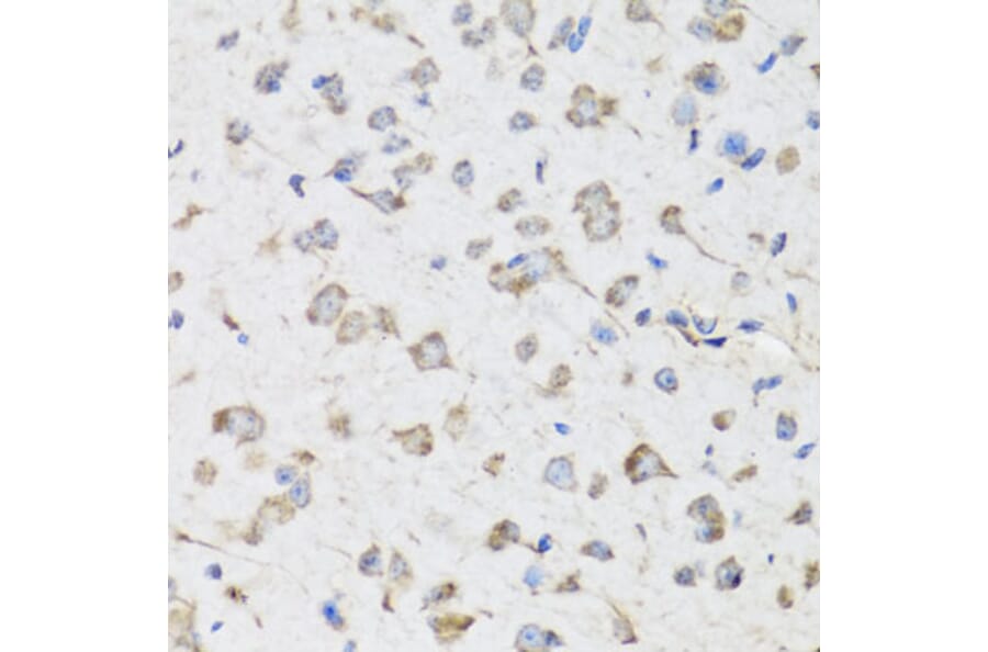 Immunohistochemistry - Anti-USP25 Antibody (A7975) - Antibodies.com