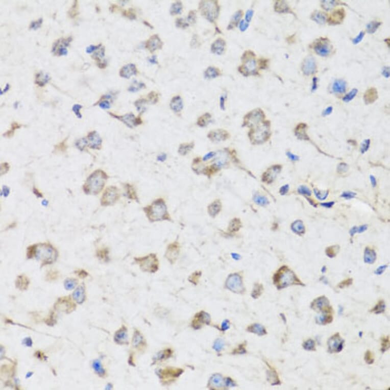 Immunohistochemistry - Anti-USP25 Antibody (A7975) - Antibodies.com