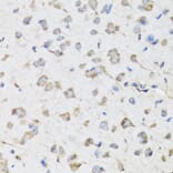 Immunohistochemistry - Anti-USP25 Antibody (A7975) - Antibodies.com