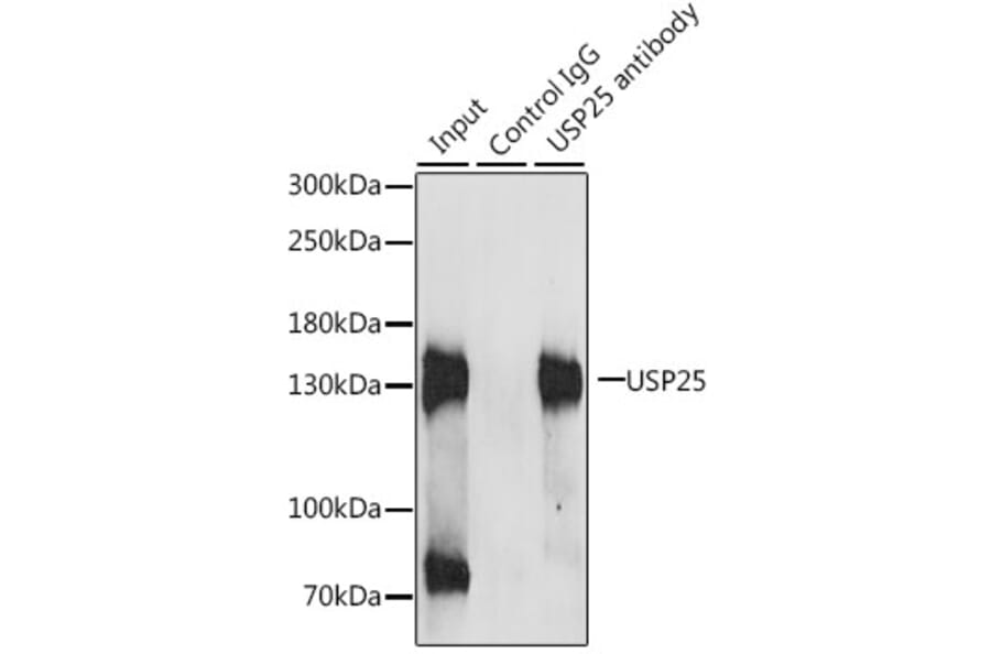Immunoprecipitation - Anti-USP25 Antibody (A7975) - Antibodies.com