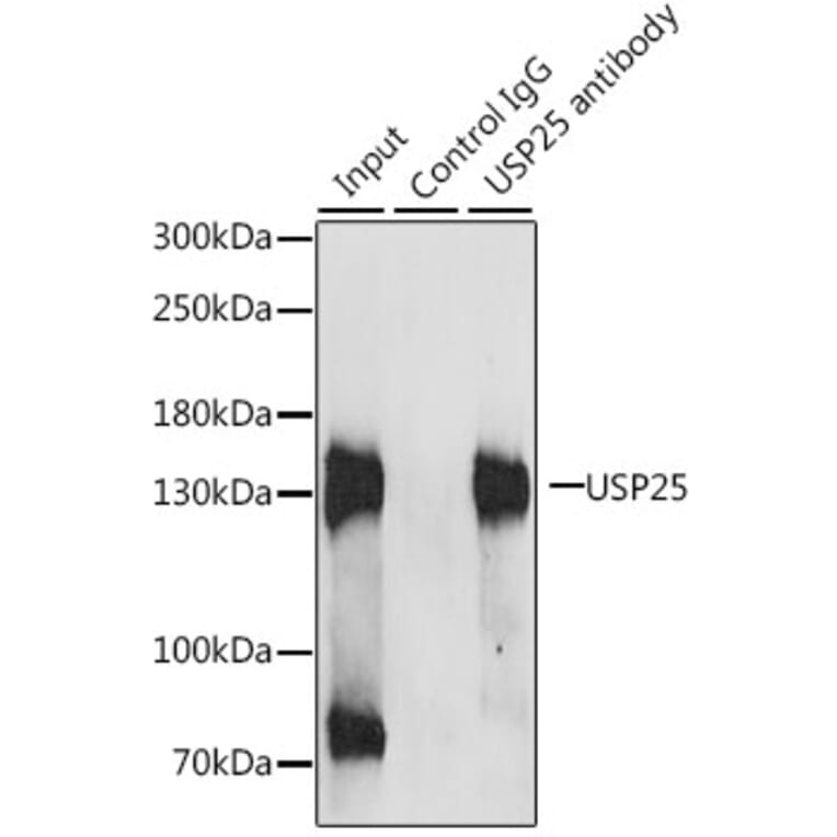 Immunoprecipitation - Anti-USP25 Antibody (A7975) - Antibodies.com