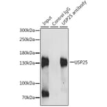 Immunoprecipitation - Anti-USP25 Antibody (A7975) - Antibodies.com