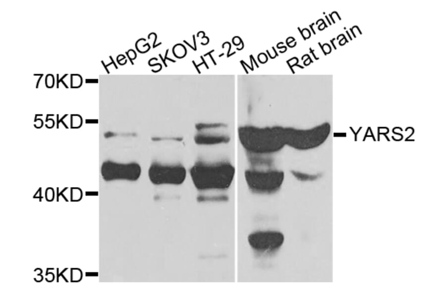 Western Blot - Anti-YARS2 Antibody (A7976) - Antibodies.com