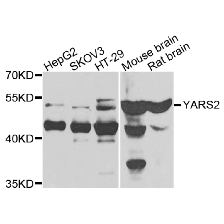 Western Blot - Anti-YARS2 Antibody (A7976) - Antibodies.com