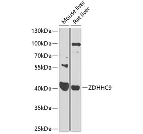 Western Blot - Anti-ZDHHC9 Antibody (A16018) - Antibodies.com