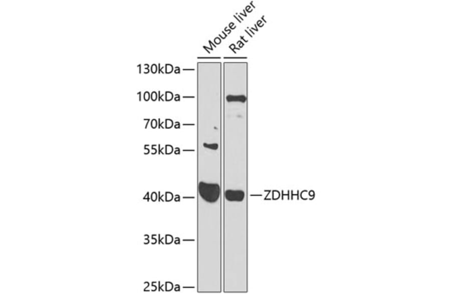 Western Blot - Anti-ZDHHC9 Antibody (A16018) - Antibodies.com