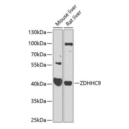 Western Blot - Anti-ZDHHC9 Antibody (A16018) - Antibodies.com
