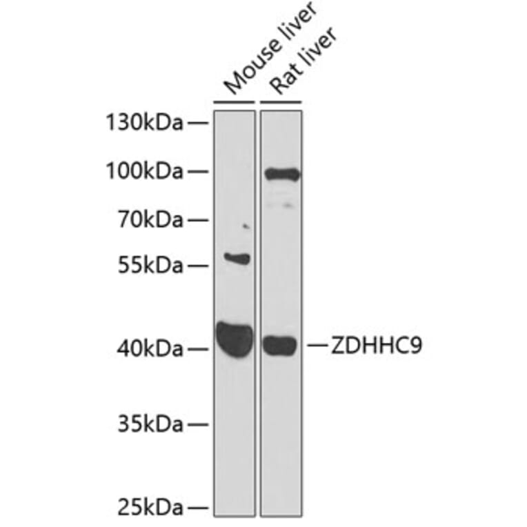 Western Blot - Anti-ZDHHC9 Antibody (A16018) - Antibodies.com