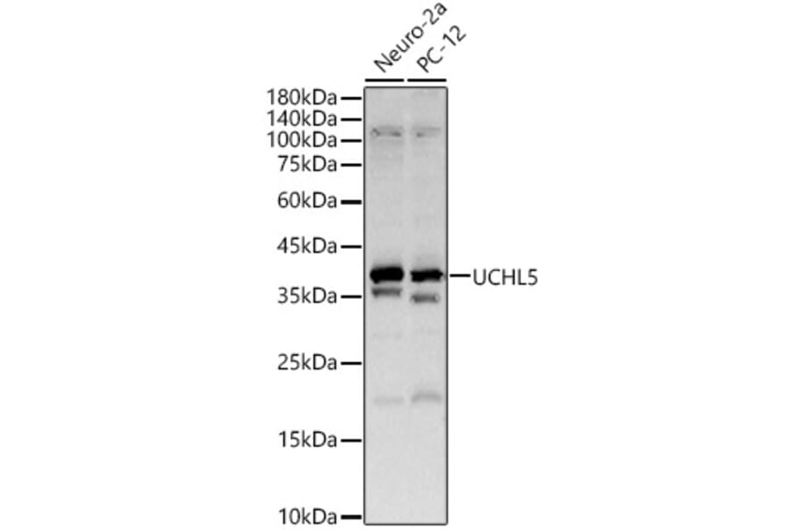 Western Blot - Anti-UCH37 Antibody (A16019) - Antibodies.com