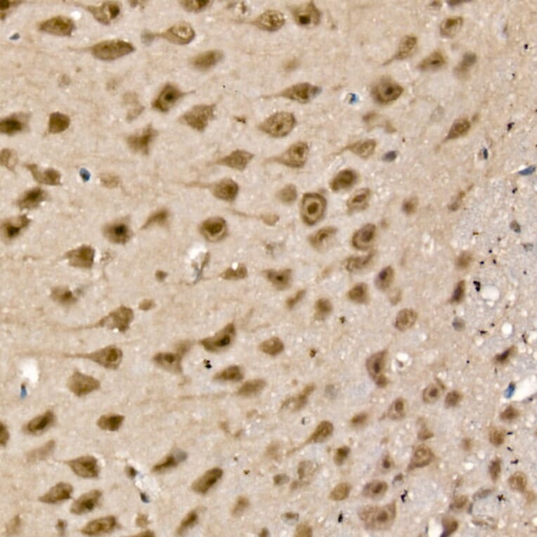 Immunohistochemistry - Anti-UCH37 Antibody (A16019) - Antibodies.com