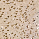 Immunohistochemistry - Anti-UCH37 Antibody (A16019) - Antibodies.com