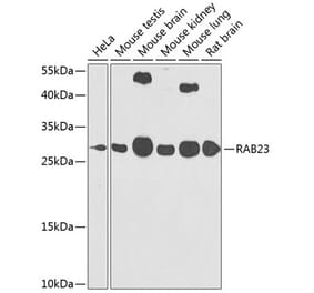 Western Blot - Anti-RAB23 Antibody (A16020) - Antibodies.com