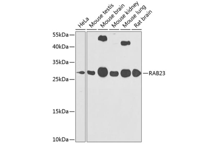 Western Blot - Anti-RAB23 Antibody (A16020) - Antibodies.com