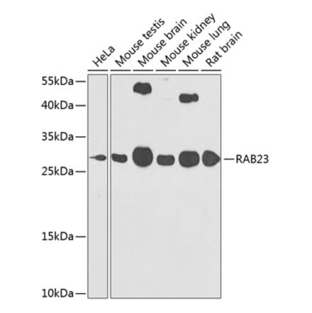 Western Blot - Anti-RAB23 Antibody (A16020) - Antibodies.com