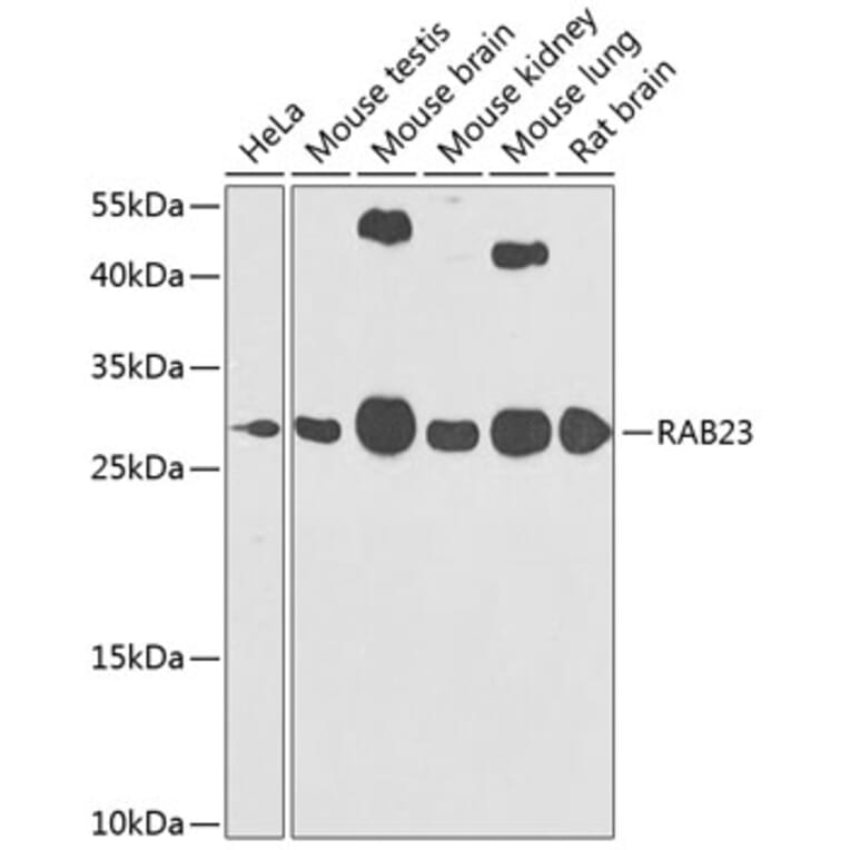 Western Blot - Anti-RAB23 Antibody (A16020) - Antibodies.com