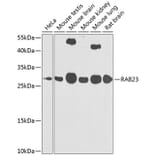 Western Blot - Anti-RAB23 Antibody (A16020) - Antibodies.com