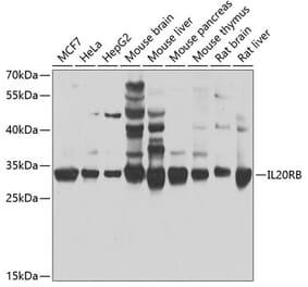 Western Blot - Anti-IL-20R2 Antibody (A16021) - Antibodies.com