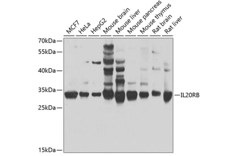 Western Blot - Anti-IL-20R2 Antibody (A16021) - Antibodies.com