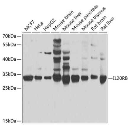 Western Blot - Anti-IL-20R2 Antibody (A16021) - Antibodies.com