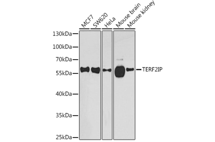 Western Blot - Anti-RAP1 Antibody (A16022) - Antibodies.com