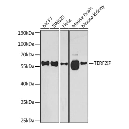 Western Blot - Anti-RAP1 Antibody (A16022) - Antibodies.com