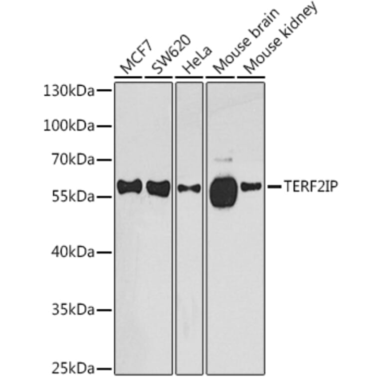 Western Blot - Anti-RAP1 Antibody (A16022) - Antibodies.com