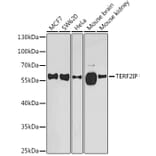 Western Blot - Anti-RAP1 Antibody (A16022) - Antibodies.com