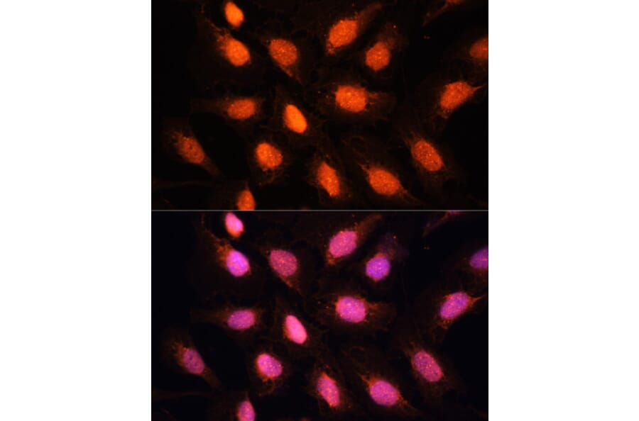 Immunofluorescence - Anti-RAP1 Antibody (A16022) - Antibodies.com