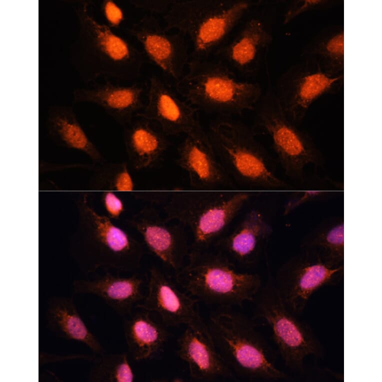 Immunofluorescence - Anti-RAP1 Antibody (A16022) - Antibodies.com
