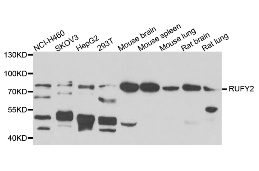 Western Blot - Anti-RUFY2 Antibody (A7983) - Antibodies.com