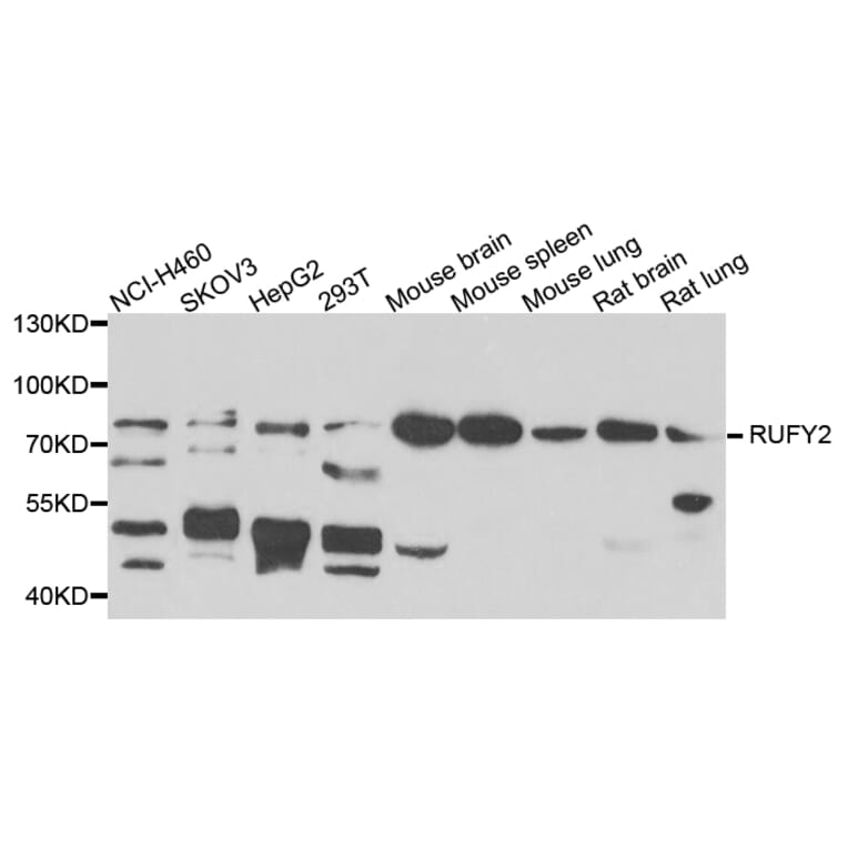 Western Blot - Anti-RUFY2 Antibody (A7983) - Antibodies.com