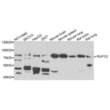 Western Blot - Anti-RUFY2 Antibody (A7983) - Antibodies.com