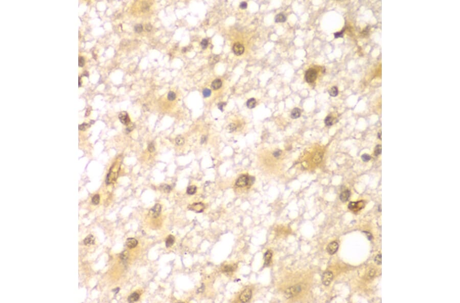 Immunohistochemistry - Anti-RUFY2 Antibody (A7983) - Antibodies.com