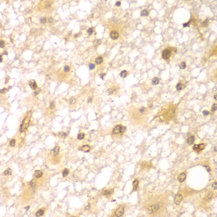 Immunohistochemistry - Anti-RUFY2 Antibody (A7983) - Antibodies.com