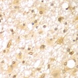 Immunohistochemistry - Anti-RUFY2 Antibody (A7983) - Antibodies.com