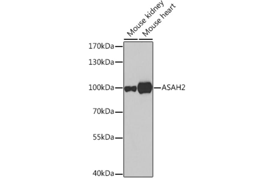 Western Blot - Anti-ASAH2 Antibody (A16024) - Antibodies.com