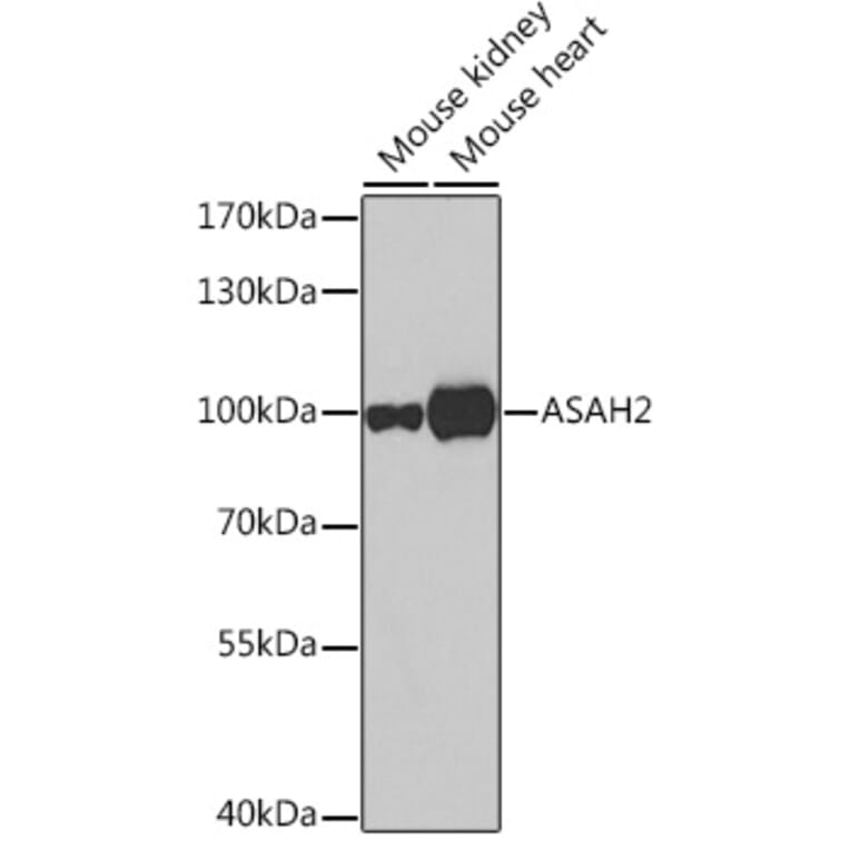 Western Blot - Anti-ASAH2 Antibody (A16024) - Antibodies.com