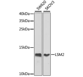 Western Blot - Anti-LSM2 Antibody (A16025) - Antibodies.com
