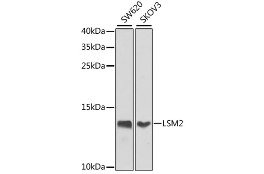 Western Blot - Anti-LSM2 Antibody (A16025) - Antibodies.com
