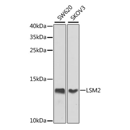 Western Blot - Anti-LSM2 Antibody (A16025) - Antibodies.com