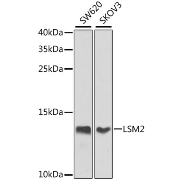Western Blot - Anti-LSM2 Antibody (A16025) - Antibodies.com